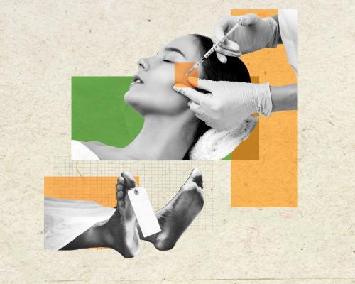 A dead person’s fat pumped into your body? Why the ‘zombie filler’ trend has some experts spooked | Antiviral