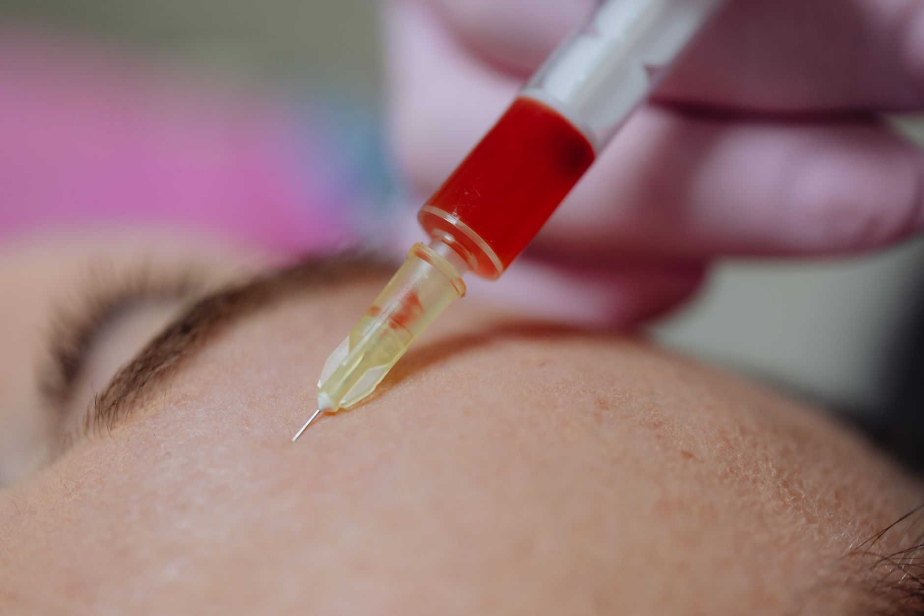 Injectables: Market & Technology Trends - DCAT Value Chain Insights