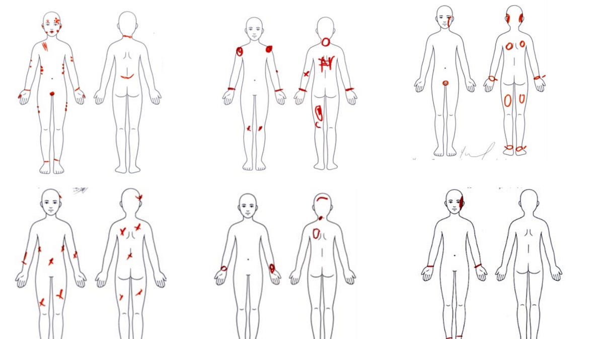 Inside Trump’s ICE Concentration Camps - by Tim Dickinson