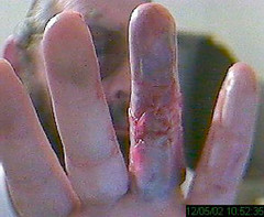 3 hurt after plane crashes in north Phoenix neighborhood - AZ Family