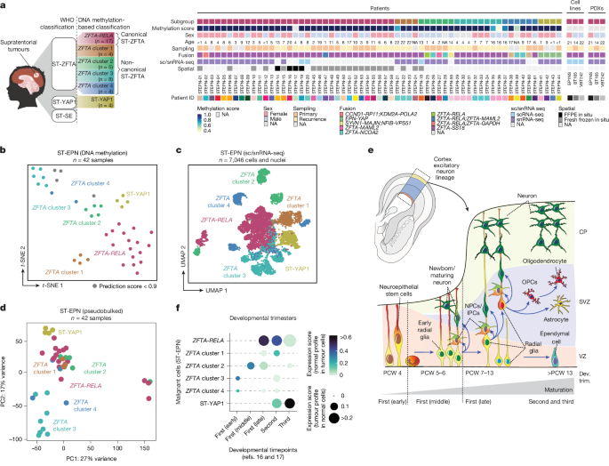 Multidimensional profiling of heterogeneity in supratentorial ependymomas