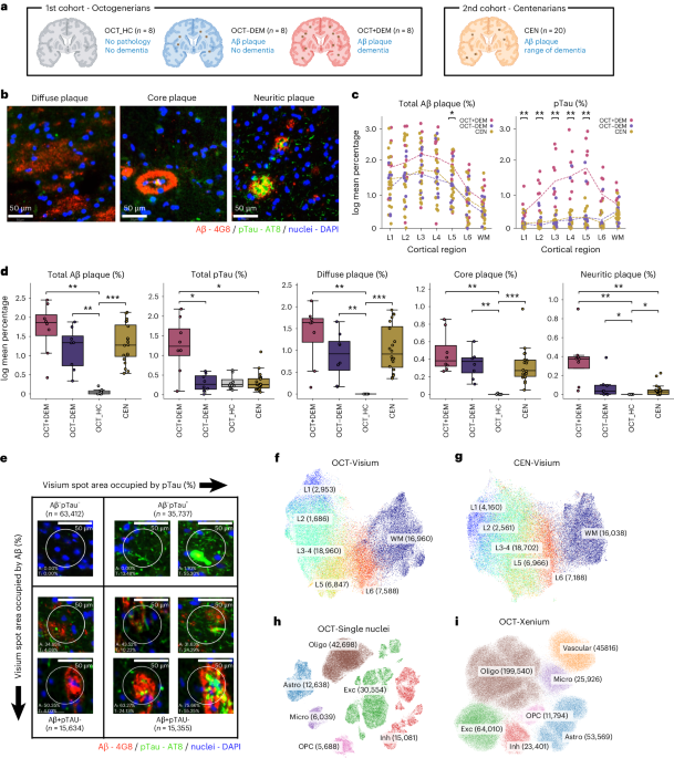 Human microglial transitions at the Aβ–tau inflection point associate with divergent pathways to dementia and resilience