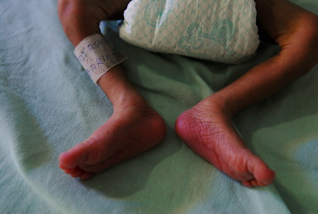 Urgent care vs emergency department: Where to go for your medical emergency - UCLA Health