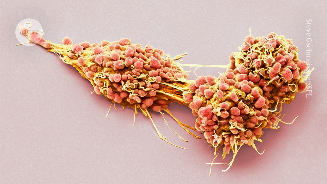 Ultra-sensitive CAR T cells eliminate hard-to-treat tumours in mice