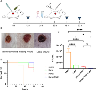 A novel isolated phage targeting Pseudomonas aeruginosa demonstrates therapeutic potential