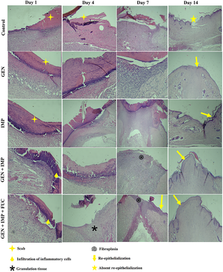 Synergistic effects of antibiotics and fucoidan on dual-species Staphylococcus aureus and Acinetobacter baumannii biofilm in diabetic rat wound models