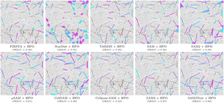 Synthetic data enables human-grade microtubule analysis with foundation models for segmentation