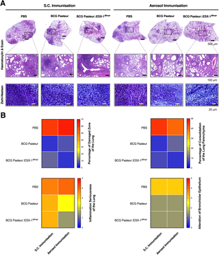 Improved immune responses and tuberculosis protection by aerosol vaccination with recombinant BCG expressing ESX-1 from Mycobacterium marinum