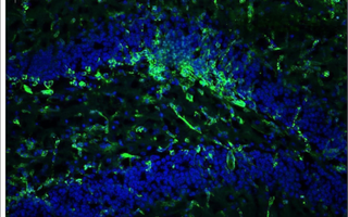 Venezuelan equine encephalitis virus infection causes chronic neurobehavioral outcomes, cellular remodeling, and hippocampal single-cell transcriptomic changes