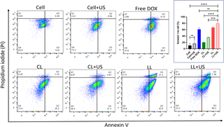 Ultrasound-triggered doxorubicin targeted delivery for liver cancer treatment: Reduced toxicity and improved efficacy