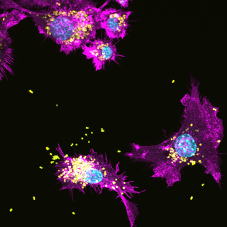 Gelatinase regulates the egress of intracellular replicating populations during Enterococcus faecalis infection