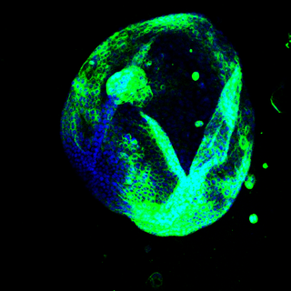 Clonorchis sinensis excretory secretory products promote hepatic fibrosis through stimulating biliary epithelium to secrete IL-17A