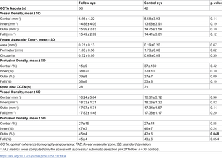Retinal microvascular alterations in children with amblyopia