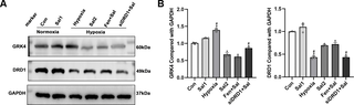 Salidroside protects against high-altitude hypoxia-induced kidney injury via regulation of renal dopamine D1-like receptors