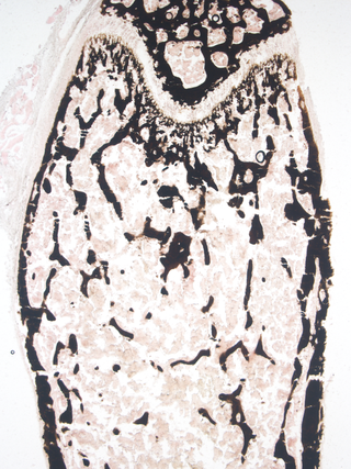 The m6Am methyltransferase PCIF1 promotes osteogenic differentiation of mesenchymal stem cells through stabilization of Wnt-related transcripts