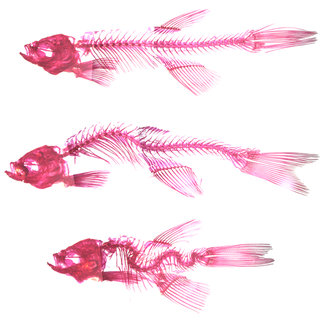Yap1 regulates motility and vertebral development and prevents kyphoscoliosis in zebrafish