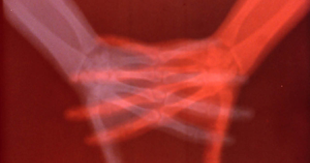 This Exhibition Proves Just How Much Art, Technology, and the Human Body Intersect